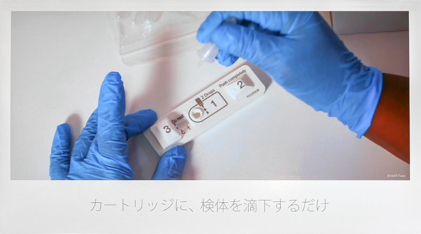 结核病快速诊断试剂盒荣获日本优秀设计大奖(图2)